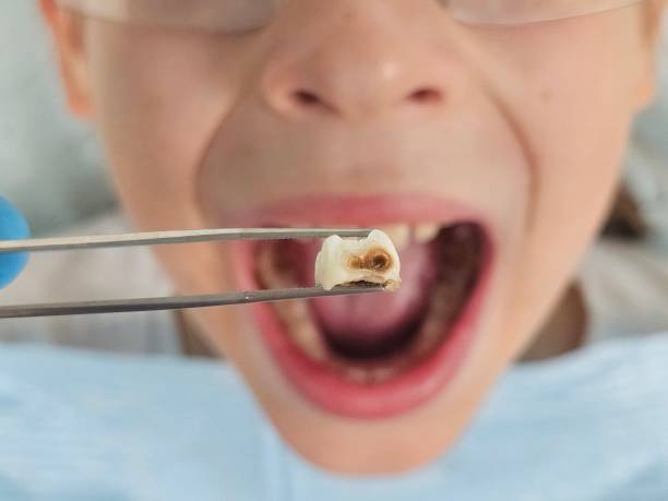 Best Mobile Emergency Dentist in Gore, OK
