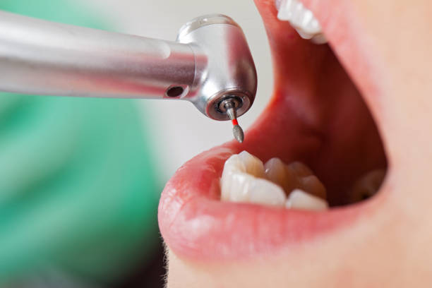 Best Orthodontic Emergency Dentist in Gore, OK